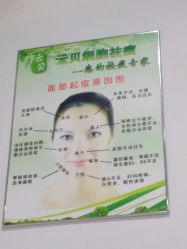 -云贝细胞祛痘痘印