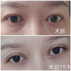点击看大图 体验前-禾丽康美医疗美容医院