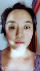 点击看大图 -禾美嘉医疗美容