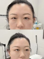 -张小野·专业半永久纹眉
