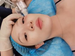 体验后-上海玫瑰医疗美容医院