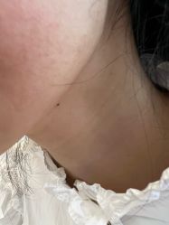 -美瑞莎创美医疗美容