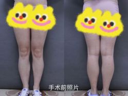 -圣嘉新医疗美容医院