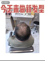 -唐风采假发补发定制