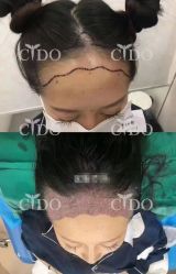 -熙朵美学植发·连锁品牌