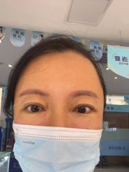 体验后-深圳美莱医疗美容医院