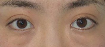 -紫洁俪方（北京）医疗美容